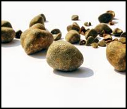 Odległe powikłania pozostawienia kamieni żółciowych w jamie otrzewnej - opis przypadku