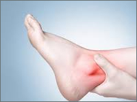 Skręcenie stawu skokowego i następstwa jego leczenia
