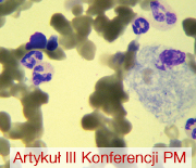 Zarys problemu chorób rzadkich na podstawie omówienia serii przypadków pacjentów z chorobą Gauchera