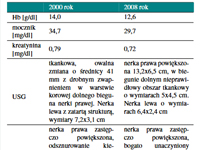 Cukrzyca i rak jasnokomórkowy nerki u pacjentki leczonej napromieniowaniem w dzieciństwie