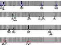 Z kazuistyki nietypowych spraw ustalania spornego ojcostwa