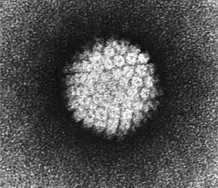 Specyfika zakażenia wirusem brodawczaka ludzkiego z obecną utajoną postacią toksoplazmozy i zakażeniem wirusem Epsteina-Barr u kobiet, które poroniły